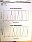 10 channel JDS C-band 200GHz demux (two 1x5 200GHz demuxes), 10 channels are from 1530.725nm to 1537.792nm . With SC/PC connectors. P/N: WD15010D2C8-NT3