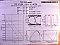 1555.75nm 14-pin 5mW /10mW DFB laser. JDS model: CQF915/408-19270. 7dBm average, 10dBm peak.